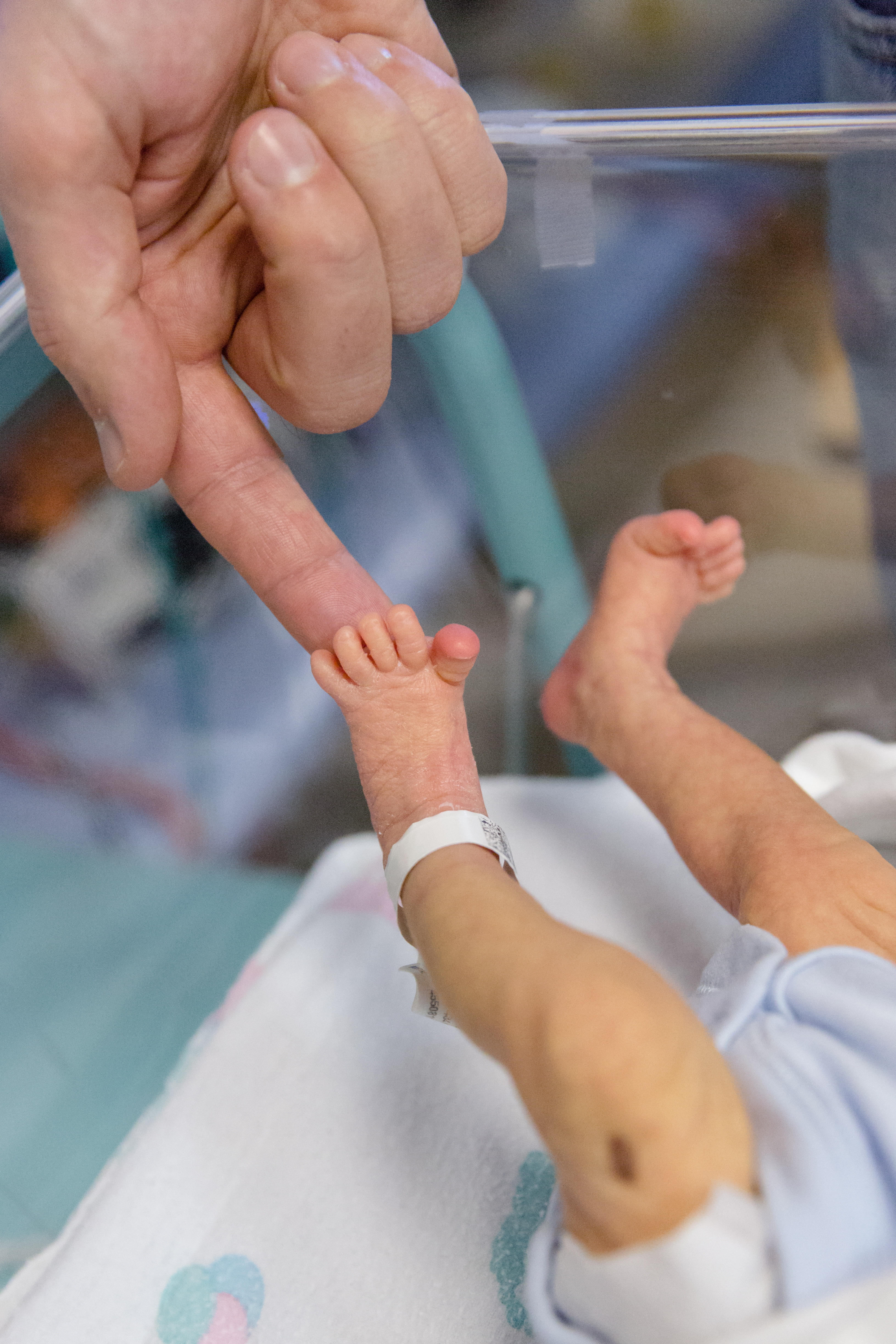 Premature baby photography Surrey